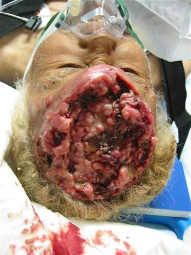 maggot1.jpg