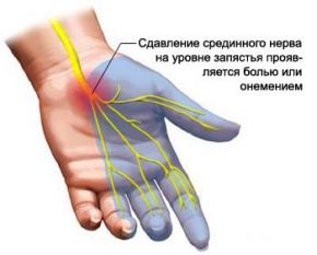 originnal_10ffd52579ab711ce3b40f9b3ade6a34.jpg